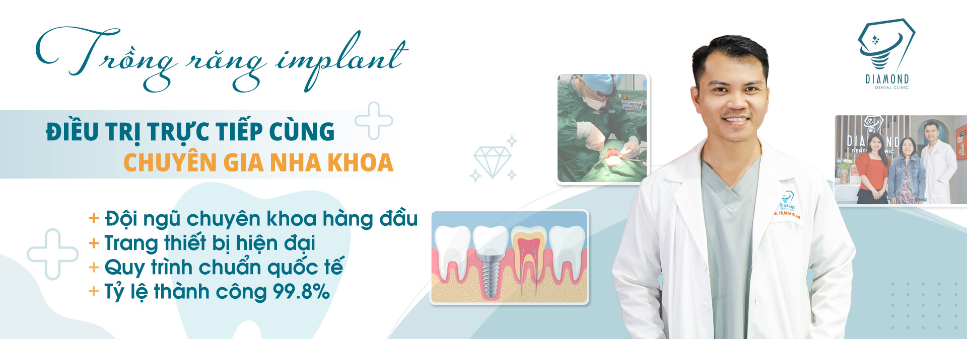 Dịch vụ trồng răng implant tại Nha khoa Diamond Biên Hòa.