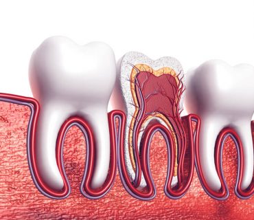 Những điều bạn cần biết về lấy tủy răng