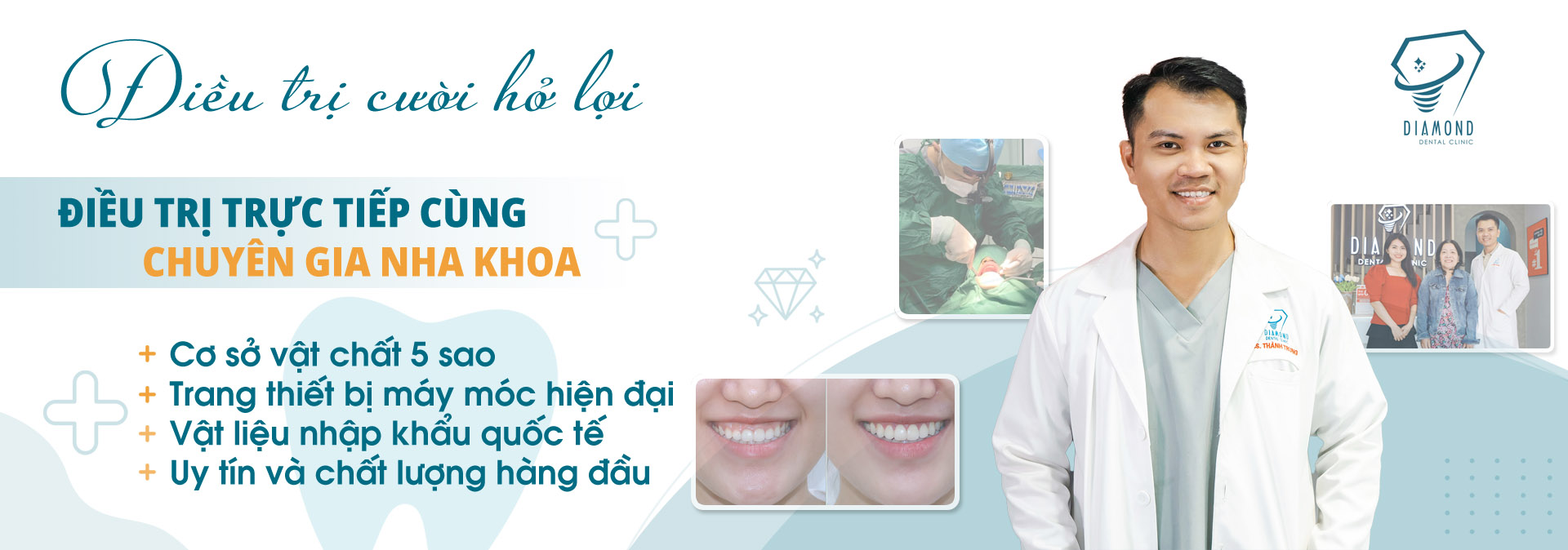 Điều trị cười hở lợi tại Nha khoa Diamond Biên Hòa.