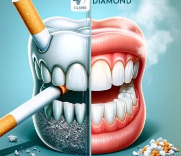 Hút Thuốc Có Thể Gây Tổn Thương Nghiêm Trọng Cho Răng Miệng