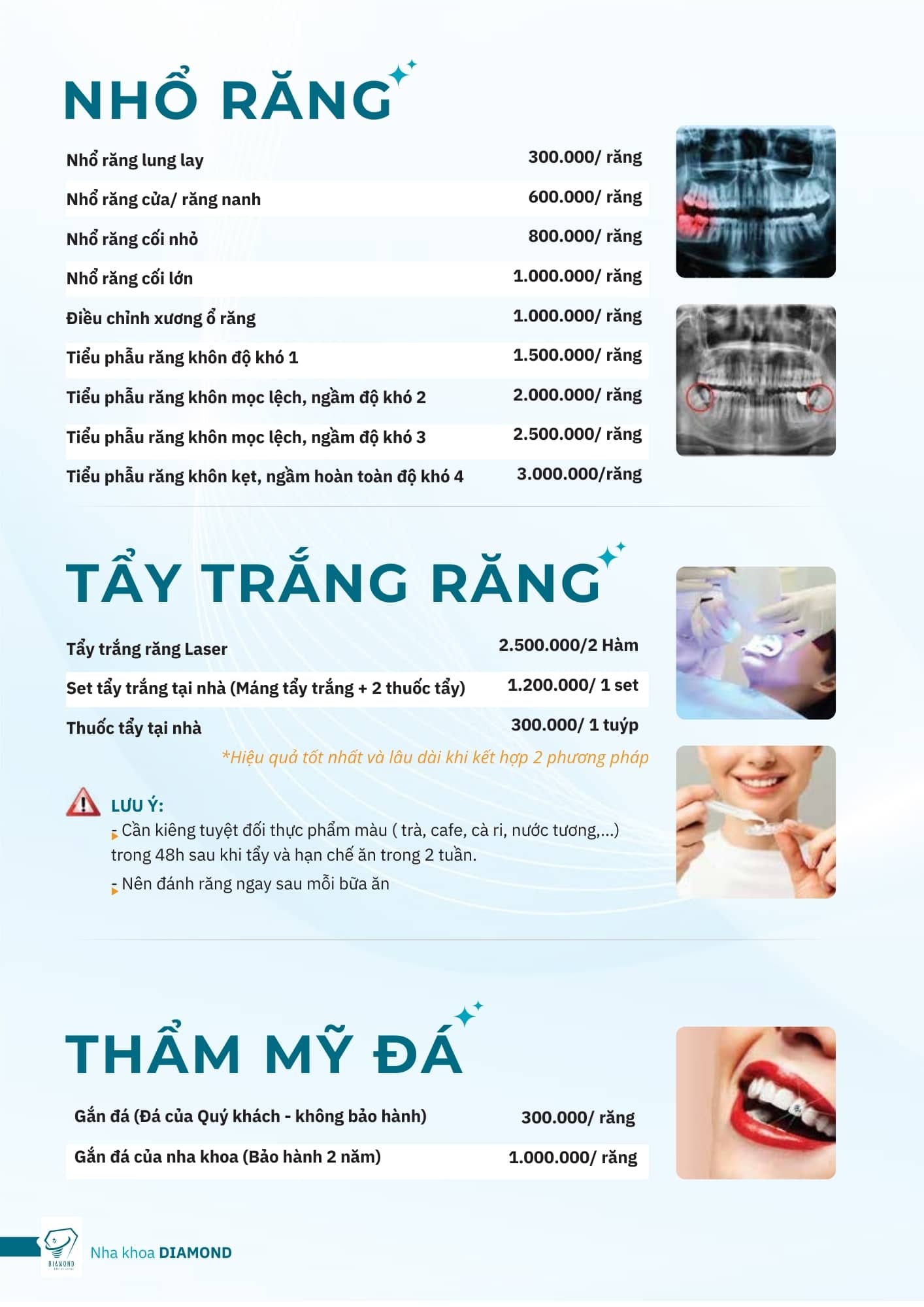 Bảng giá nhổ răng nha khoa Diamond Biên Hoà