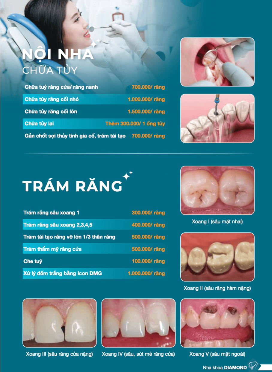 Bảng nha trám răng nha khoa uy tín Biên Hoà
