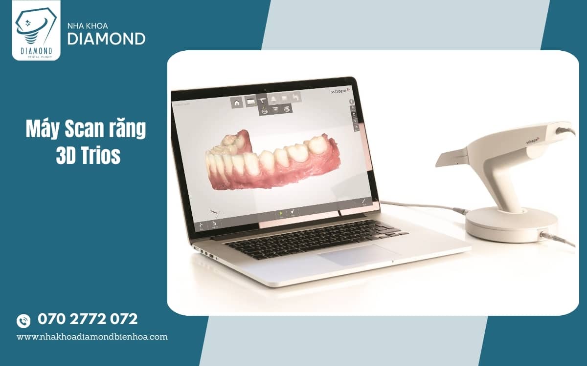 Máy scan răng 3D Trios nha khoa Diamond Biên Hoà Máy scan răng 3D Trios nha khoa Diamond Biên Hoà