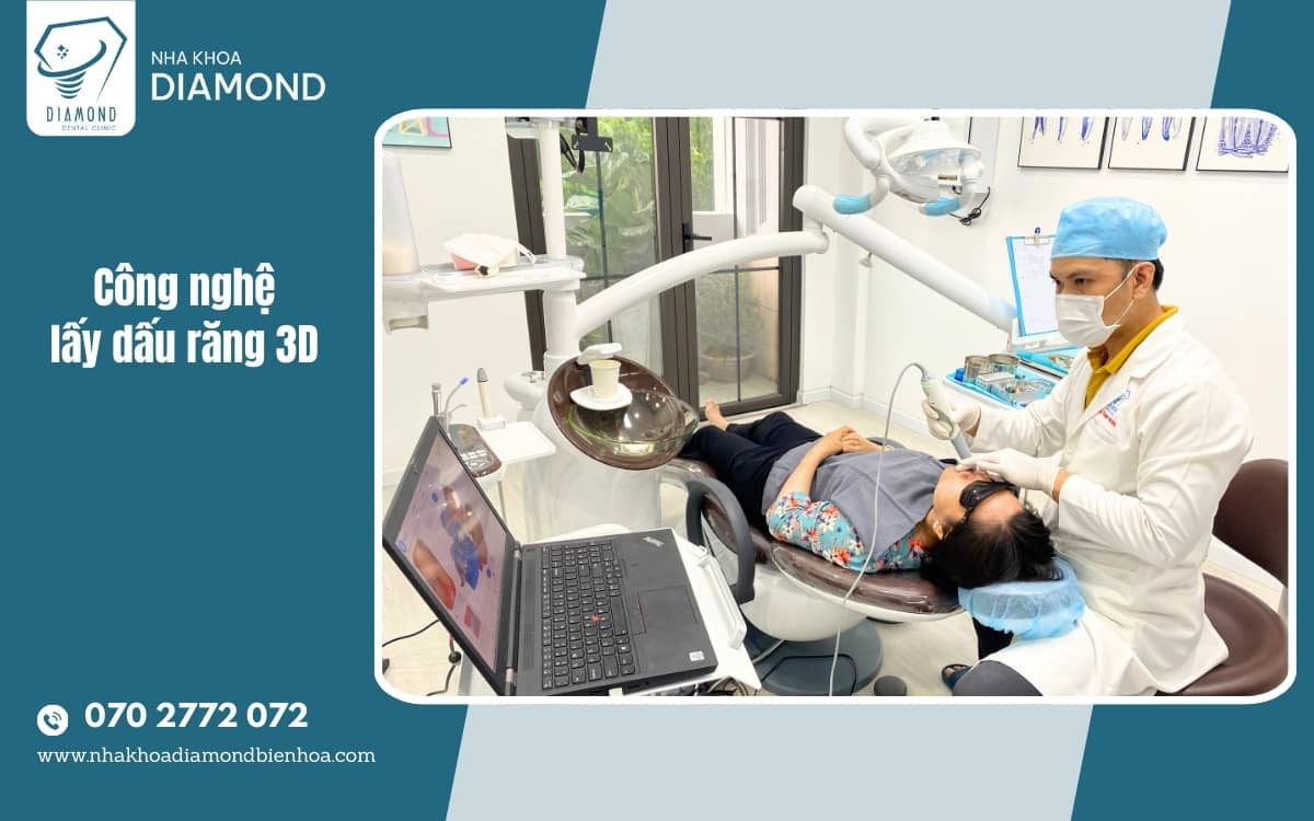Scan răng 3D tại nha khoa Diamond Bien hoa