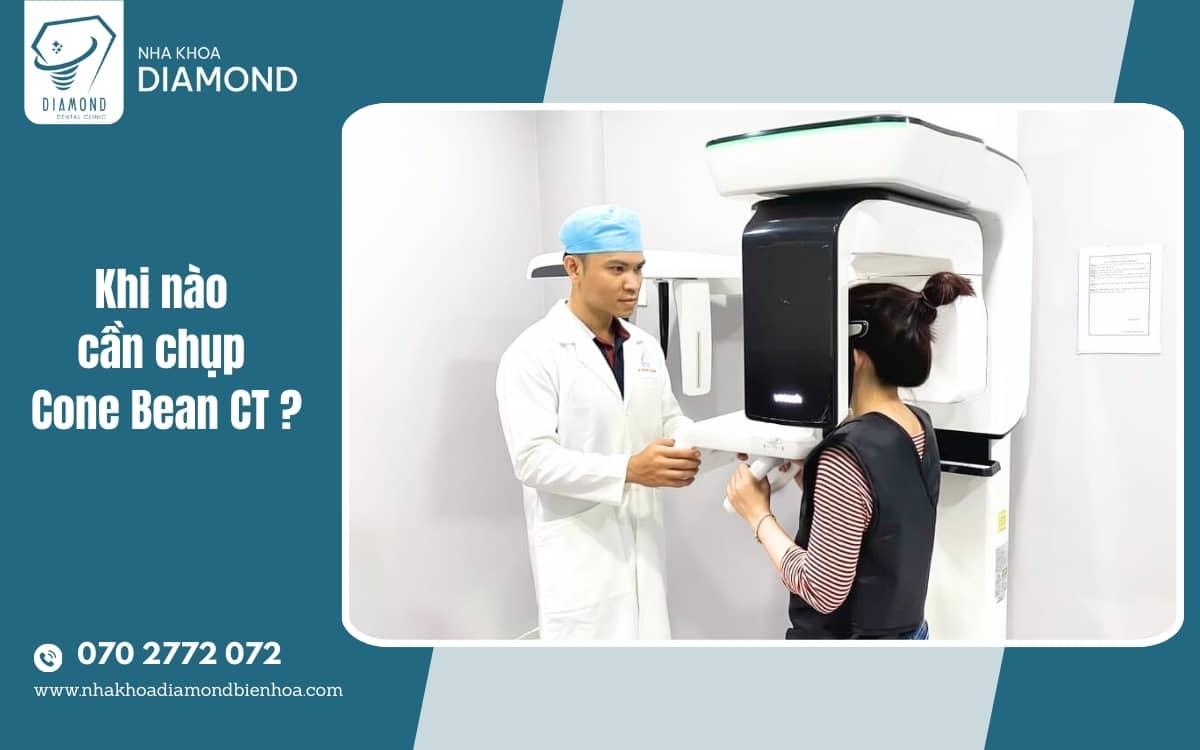 khi nao cần chụp CBCT