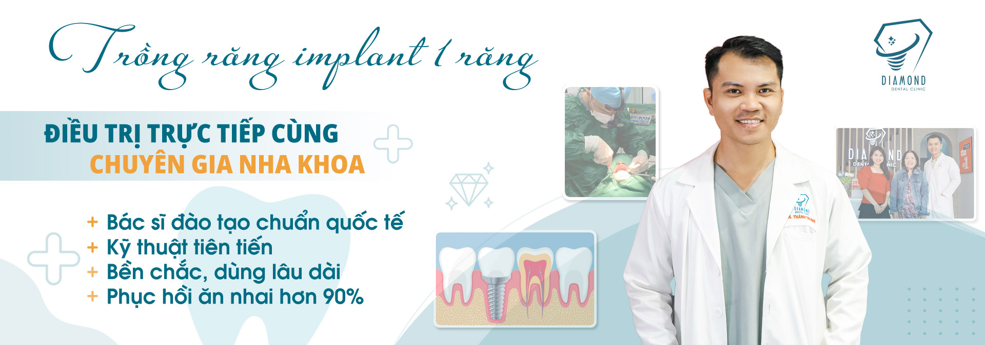 Dịch vụ trồng răng implant 1 răng tại Nha khoa Diamond Biên Hòa.