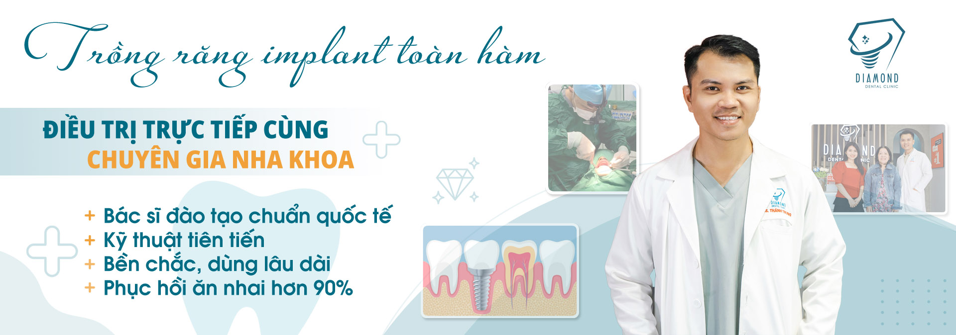 Dịch vụ trồng răng implant toàn hàm tại Nha khoa Diamond Biên Hòa.