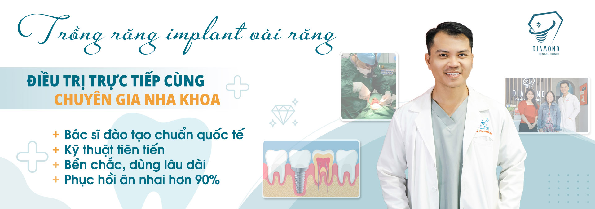 Dịch vụ trồng răng implant một vài răng tại Nha khoa Diamond Biên Hòa.
