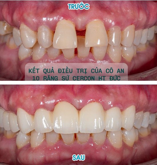 Cô An, 67 tuổi, Việt kiều, Hoa Kỳ 🇺🇸
