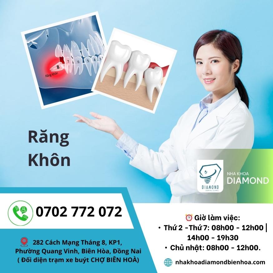 Dịch vụ nhổ răng khôn tại Nha khoa Diamond